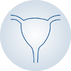 Uterine Fibroids